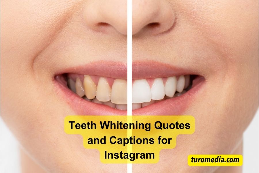 Teeth Whitening Quotes and Captions for Instagram